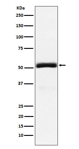 Granulin (18Q13) Rabbit Monoclonal Antibody