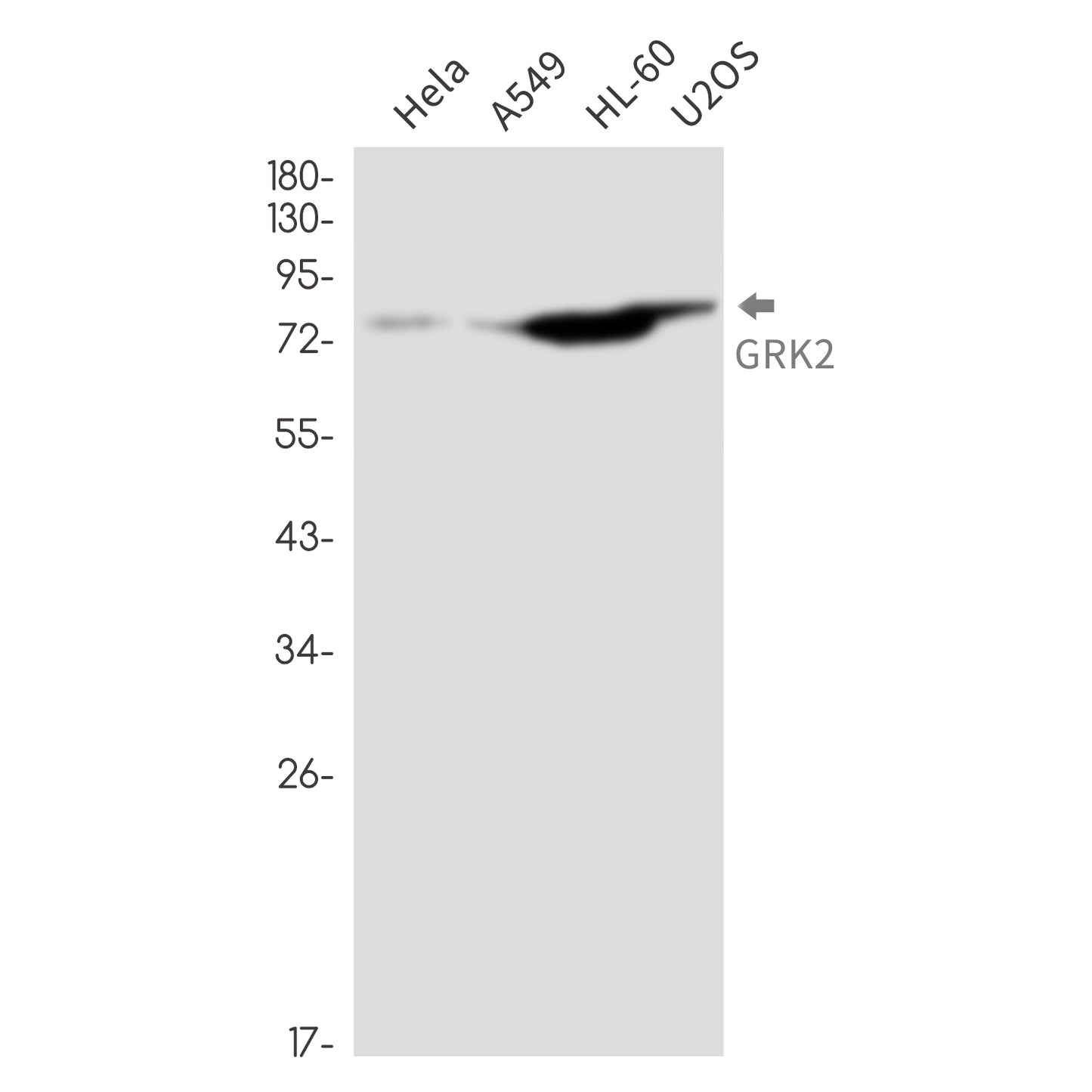 GRK2 (12K5) Rabbit Monoclonal Antibody