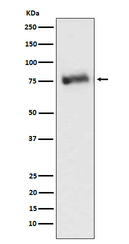 GRK3 (15U16) Rabbit Monoclonal Antibody