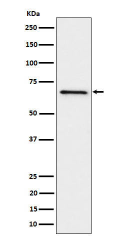 GRK6 (17B2) Rabbit Monoclonal Antibody