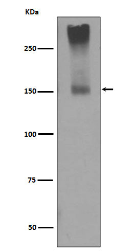 GRM5   (6R13) Rabbit Monoclonal Antibody