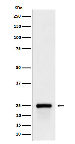 GSTA4 (2P11) Rabbit Monoclonal Antibody