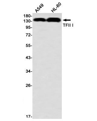 GTF2I (1A17) Rabbit Monoclonal Antibody
