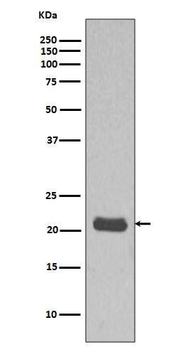 GTPase HRAS (1G13) Rabbit Monoclonal Antibody