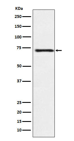 Guanylyl Cyclase beta 1 (19P14) Rabbit Monoclonal Antibody