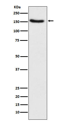 Hamartin (7O10) Rabbit Monoclonal Antibody