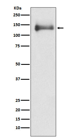 HDAC4 (14G14) Rabbit Monoclonal Antibody