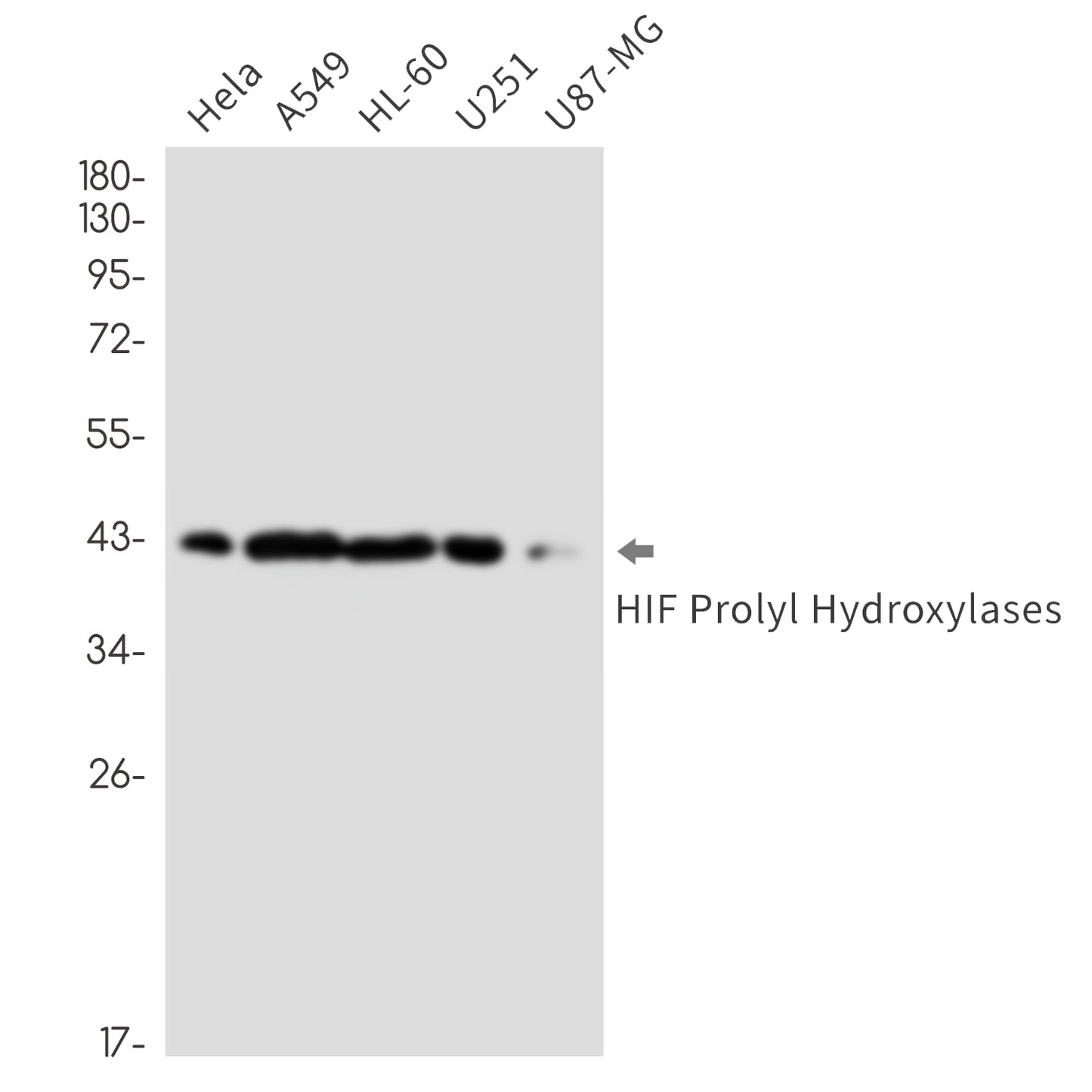 HIF Prolyl Hydroxylases (11V1) Rabbit Monoclonal Antibody