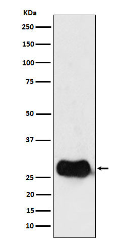 HLA DMB (14D11) Rabbit Monoclonal Antibody