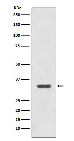HLA-DRA (4K6) Rabbit Monoclonal Antibody