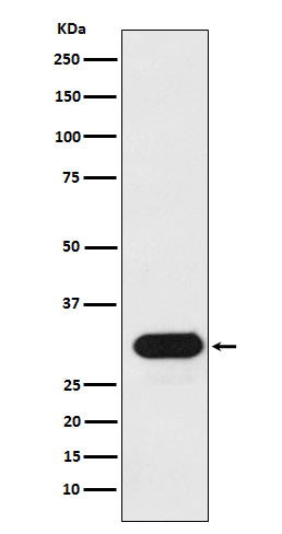 HLA-Drb1 (11B17) Rabbit Monoclonal Antibody