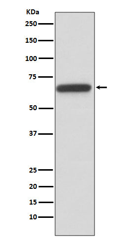 HNF1 beta (15Y3) Rabbit Monoclonal Antibody