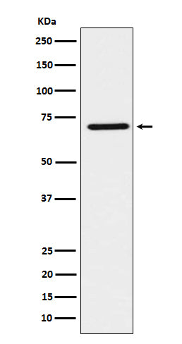HNF1 beta (17N9) Rabbit Monoclonal Antibody
