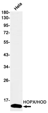 HOPX (1F18) Rabbit Monoclonal Antibody