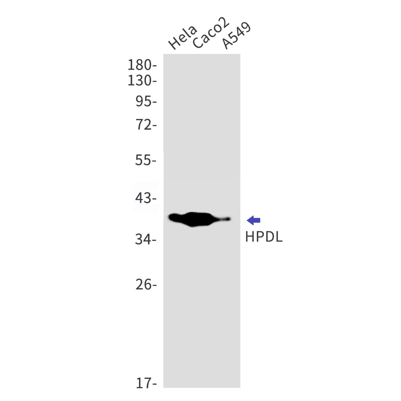 HPDL (3C9) Rabbit Monoclonal Antibody