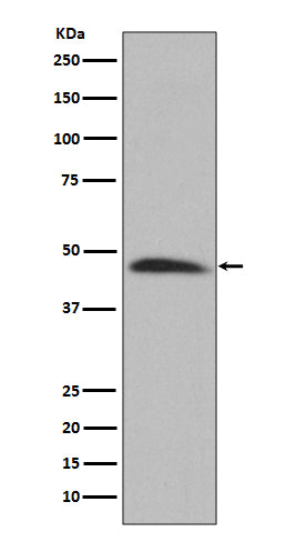 Hsp47 (18D10) Rabbit Monoclonal Antibody