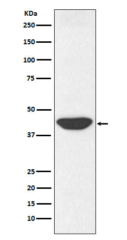 IDH1 (2P17) Rabbit Monoclonal Antibody