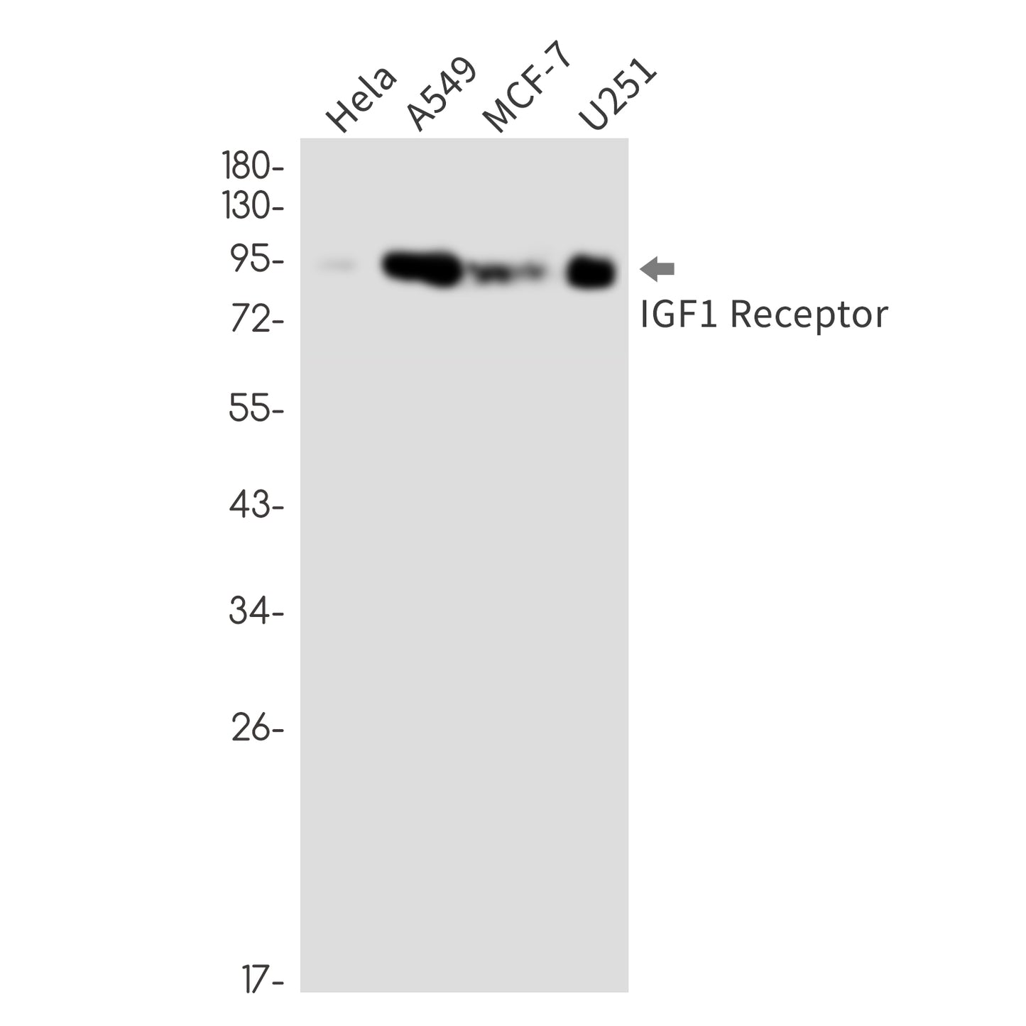 IGF1 Receptor (18P7) Rabbit Monoclonal Antibody