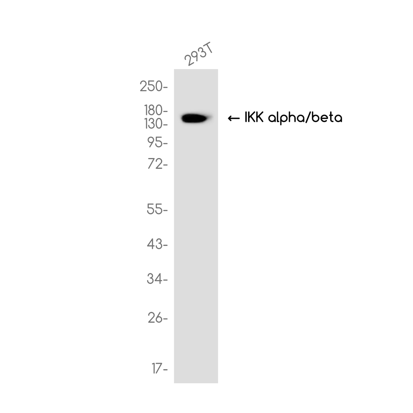 IKK alpha/beta (10K2) Rabbit Monoclonal Antibody
