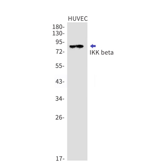 IKK beta (11A19) Rabbit Monoclonal Antibody