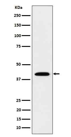 IL12B (2Q3) Rabbit Monoclonal Antibody
