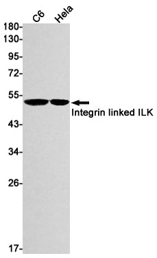 ILK (13L8) Rabbit Monoclonal Antibody