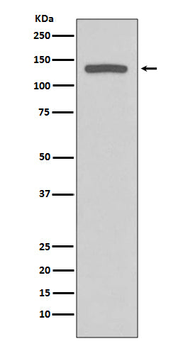 iNOS (12H16) Rabbit Monoclonal Antibody