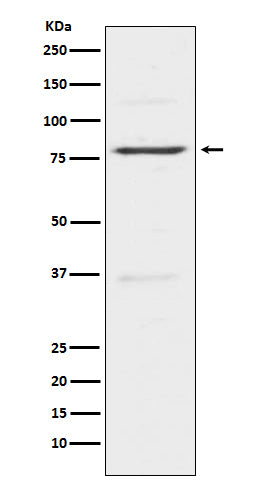 Insulin Receptor R (13V2) Rabbit Monoclonal Antibody