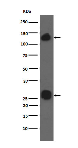 Integrin alpha V (13Z12) Rabbit Monoclonal Antibody
