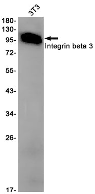 Integrin beta 3  (15D18) Rabbit Monoclonal Antibody