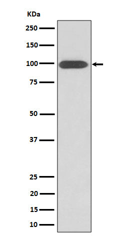 Integrin beta 3 / CD61 (6R14) Rabbit Monoclonal Antibody