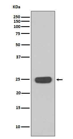 Interferon gamma (16O15) Rabbit Monoclonal Antibody