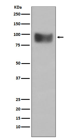 Interferon Receptor alpha (15I18) Rabbit Monoclonal Antibody