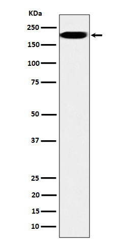 IQGAP2 (18P19) Rabbit Monoclonal Antibody