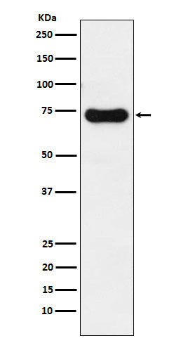 IRAK2 (2Q15) Rabbit Monoclonal Antibody