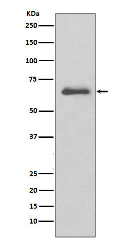 IRAK3 (17H10) Rabbit Monoclonal Antibody