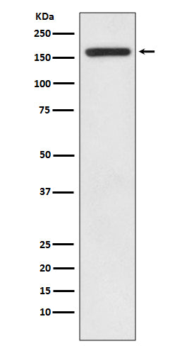 IRS1 (17G5) Rabbit Monoclonal Antibody