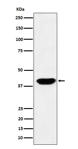 Islet1 (18N15) Rabbit Monoclonal Antibody