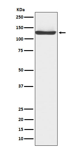JAK3 (3T5) Rabbit Monoclonal Antibody