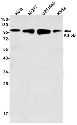 KIF5B (9K4) Rabbit Monoclonal Antibody