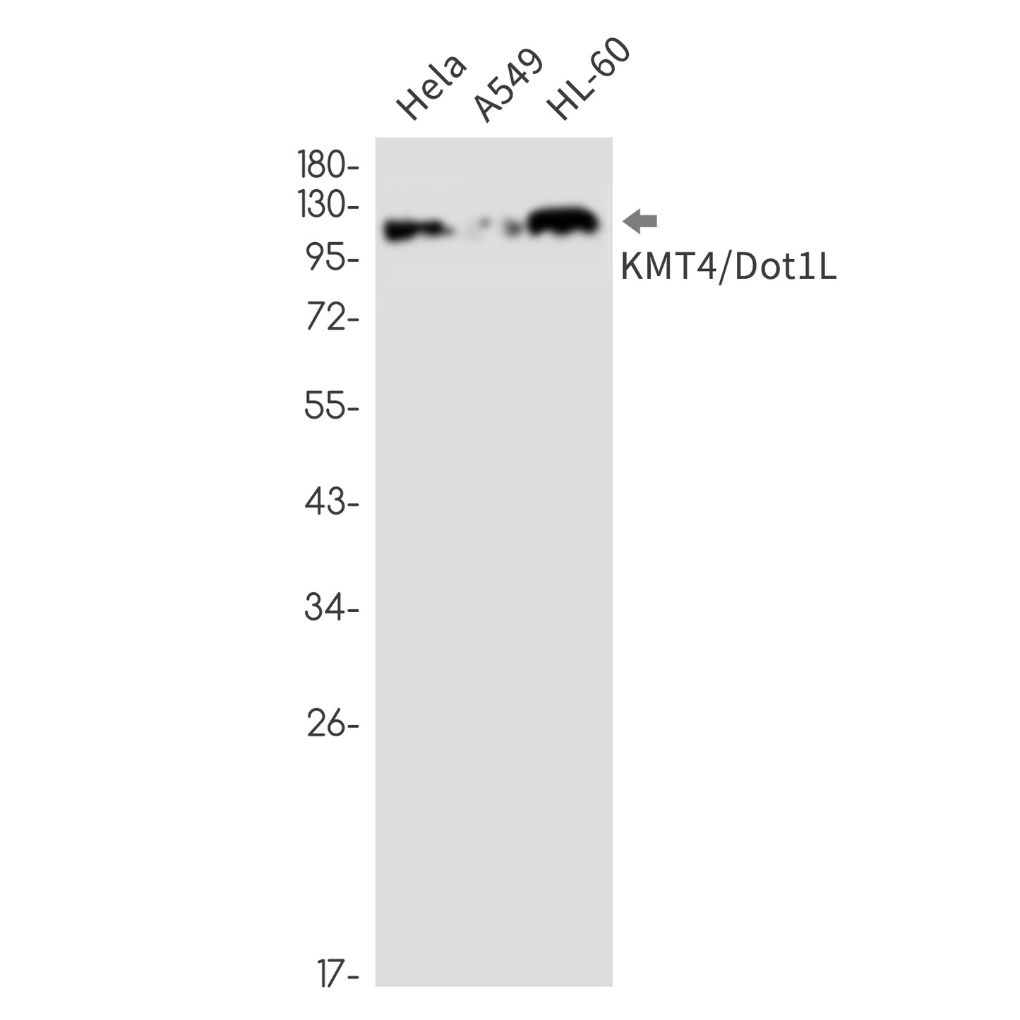 KMT4 / Dot1L  (9V11) Rabbit Monoclonal Antibody
