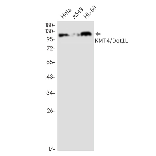 KMT4 / Dot1L  (9V11) Rabbit Monoclonal Antibody