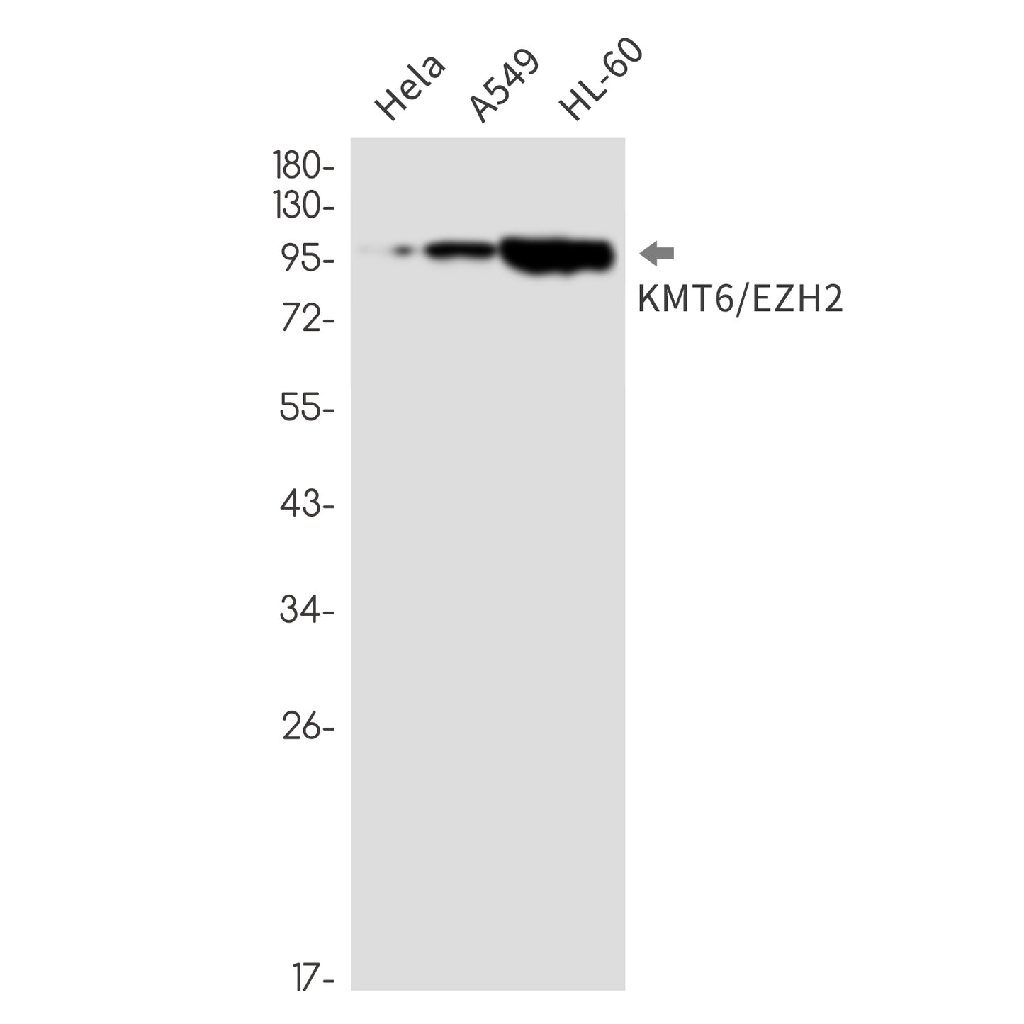KMT6 / EZH2 (15A18) Rabbit Monoclonal Antibody