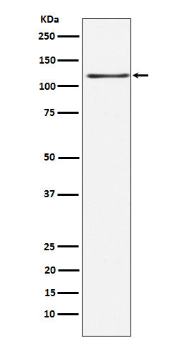 KSR1 (5X11) Rabbit Monoclonal Antibody