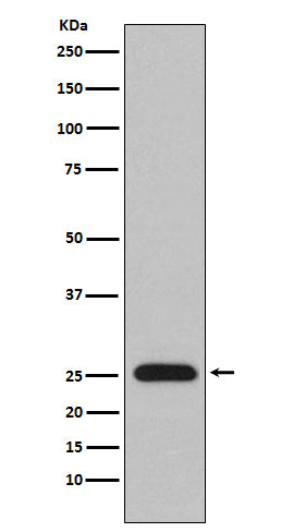 Lambda Light chain (14H15) Rabbit Monoclonal Antibody