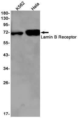 Lamin B Receptor (17J19) Rabbit Monoclonal Antibody
