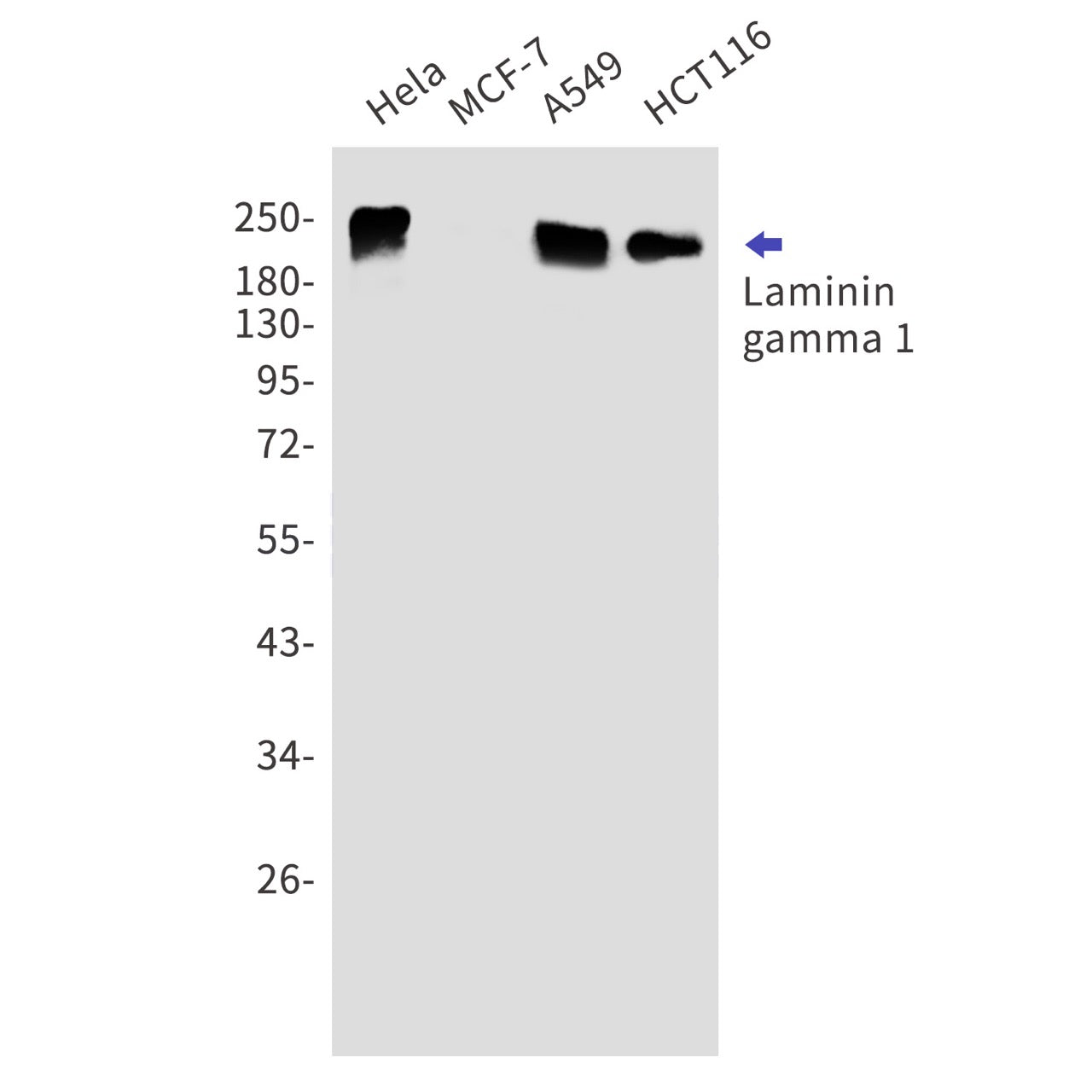 Laminin gamma 1 (9A17) Rabbit Monoclonal Antibody