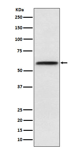 LCAT (4S11) Rabbit Monoclonal Antibody
