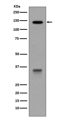 LDL Receptor  (14L10) Rabbit Monoclonal Antibody