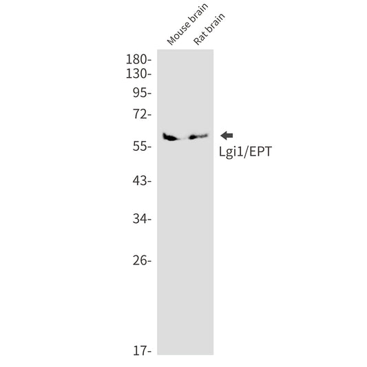 Lgi1 (18F12) Rabbit Monoclonal Antibody